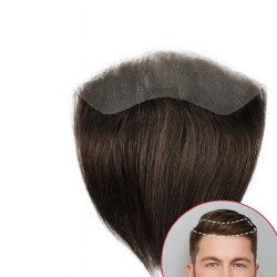Men's Frontal Hairpiece - Darkest Brown (Color 2), Receding Hairline Coverage, 100% Remy Indian Human Hair