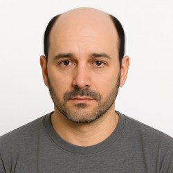 Men's Hair System - Off Black (Color 1B), Ultra-Thin 0.03mm Skin Base, 100% Remy Indian Human Hair