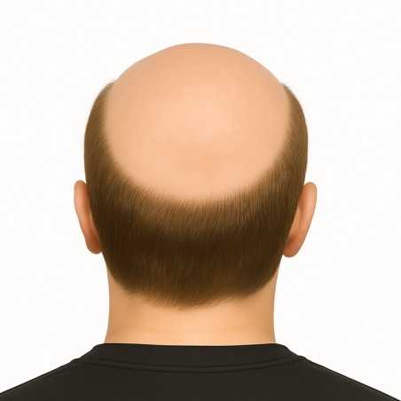 Men’s Hair System – Light Ash Brown (Color 8R), Super-Thin 0.08mm Skin Base, 100% Remy Indian Human Hair