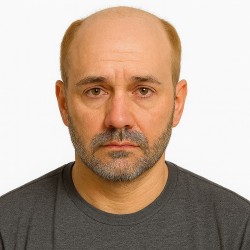 Men’s Hair System – Light Blonde (Color 22), Super-Thin 0.08mm Skin Base, 100% Remy Indian Human Hair