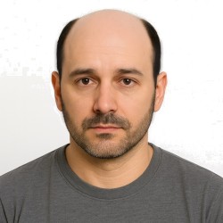 Men’s Hair System – Darkest Brown (Color 2), French Lace Base with Poly Edge, 100% Remy Indian Human Hair