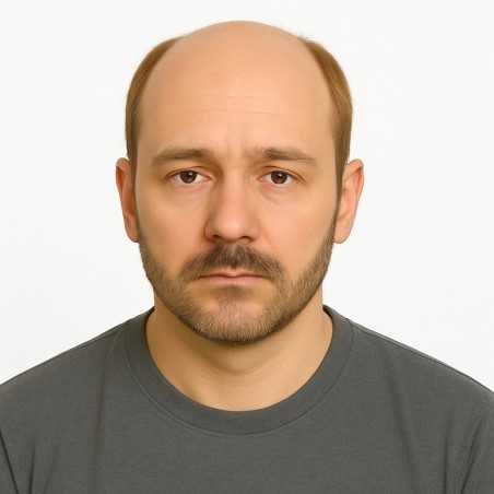 Men's Hair System – Dark Blonde (Color 18), Fine Mono Base with Skin Perimeter and French Lace Front, 100% Remy Indian Hair