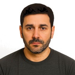 Men's Hair System - Darkest Brown (Color 2), Super-Thin 0.08mm Skin Base with French Lace Front, 100% Remy Indian Human Hair