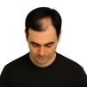 Men's Frontal Hairpiece - Jet Black (Color 1), Receding Hairline Coverage, 100% Remy Indian Human Hair