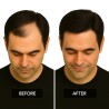 Men's Frontal Hairpiece - Jet Black (Color 1), Receding Hairline Coverage, 100% Remy Indian Human Hair
