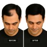 Men's Frontal Hairpiece - Darkest Brown (Color 2), Receding Hairline Coverage, 100% Remy Indian Human Hair