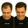 Men's Frontal Hairpiece - Dark Brown (Color 4), Receding Hairline Coverage, 100% Remy Indian Human Hair