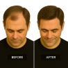 Men's Frontal Hairpiece - Medium Brown (Color 6), Receding Hairline Coverage, 100% Remy Indian Human Hair