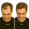 Men's Frontal Hairpiece - Light Medium Brown (Color 7), Receding Hairline Coverage, 100% Remy Indian Human Hair