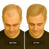 Men's Frontal Hairpiece - Light Blonde (Color 22), Receding Hairline Coverage, 100% Remy Indian Human Hair