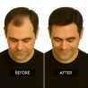 Men's Frontal Hairpiece - Dark Brown with Ash Tone (Color 4ASH), Receding Hairline Coverage, 100% Remy Indian Human Hair