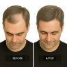 Men's Frontal Hairpiece - Light Brown with Ash Tone (Color 7ASH), Receding Hairline Coverage, 100% Remy Indian Human Hair