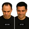 Men's 7x4 Frontal Hairpiece - Black (Color 1A), Receding Hairline Coverage, 100% Remy Indian Human Hair