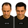 Men's 7x4 Frontal Hairpiece - Darkest Brown (Color 2), Receding Hairline Coverage, 100% Remy Indian Human Hair