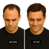 Men's 7x4 Frontal Hairpiece - Medium Brown (Color 6), Receding Hairline Coverage, 100% Remy Indian Human Hair
