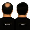 Men’s Frontal Hairpiece - Off Black (Color 1B), Partial Crown Coverage, 100% Remy Indian Human Hair