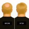 Men’s Frontal Hairpiece - Light Blonde (Color 22), Partial Crown Coverage, 100% Remy Indian Human Hair